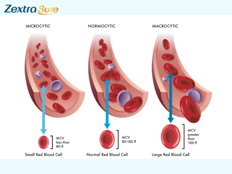 does-high-mcv-mean-cancer (3)
